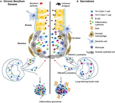 Adaptive Immunity in Pulmonary Sarcoidosis and Chronic Beryllium Disease